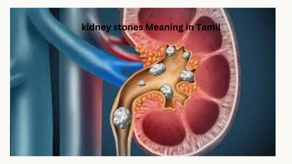 Kidney Stone Meaning in Tamil: பல காரணங்கள் உள்ளது!!