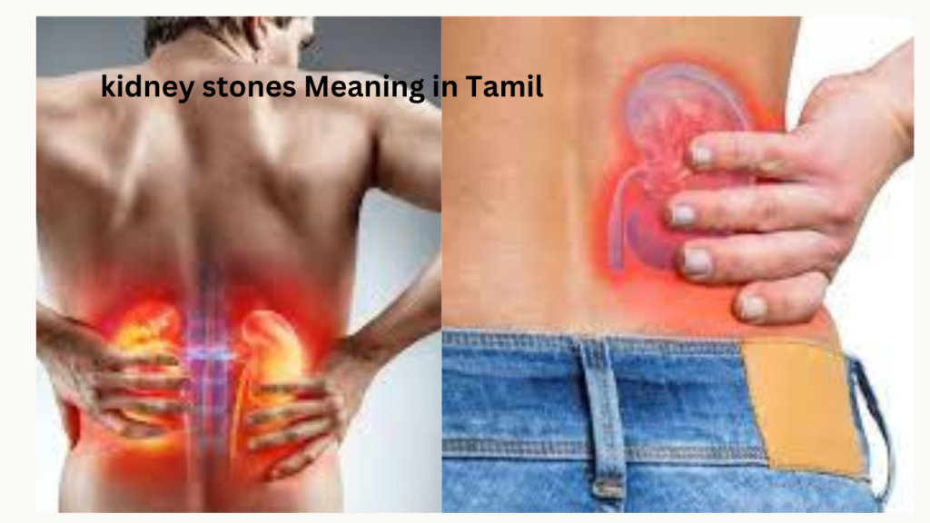 Kidney Stone Meaning in Tamil